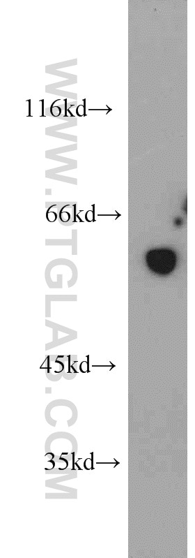 Western Blot (WB) analysis of PC-3 cells using FKBP52 Polyclonal antibody (10655-1-AP)