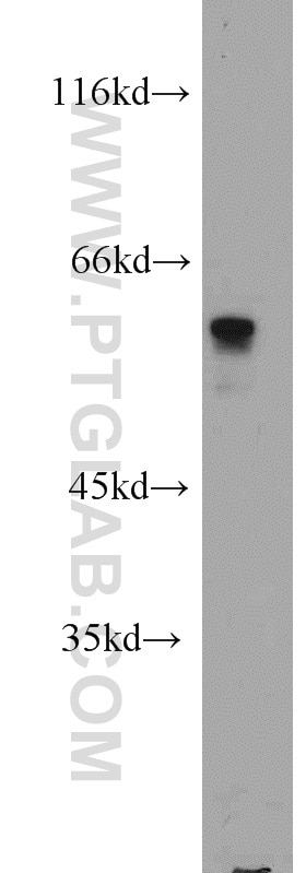 Western Blot (WB) analysis of Jurkat cells using FKBP52 Polyclonal antibody (10655-1-AP)