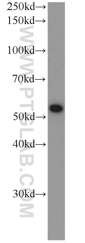 Western Blot (WB) analysis of NIH/3T3 cells using FKBP52 Polyclonal antibody (10655-1-AP)