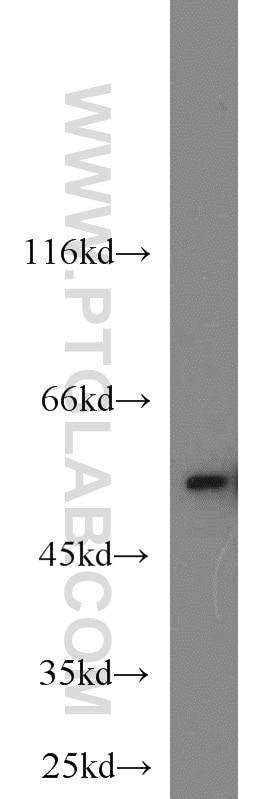 Western Blot (WB) analysis of PC-3 cells using FKBP52 Polyclonal antibody (10655-1-AP)