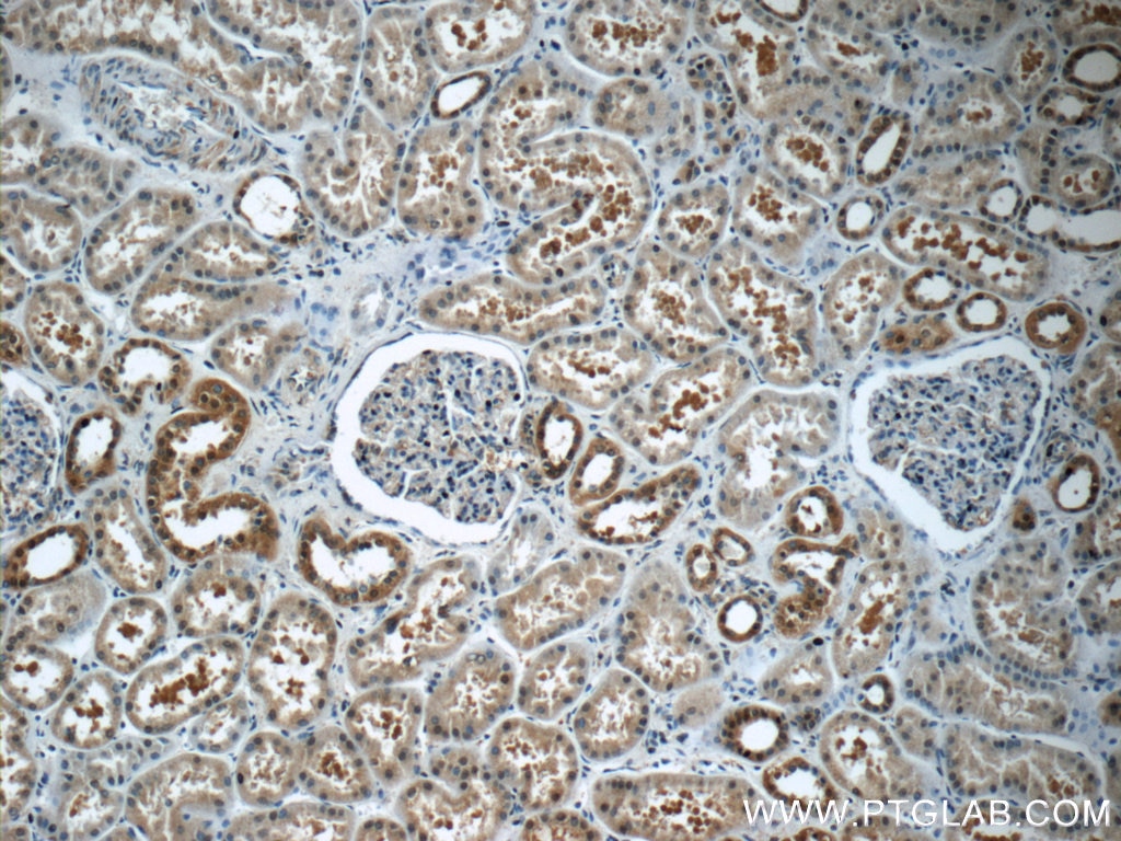 IHC staining of human kidney using 22623-1-AP