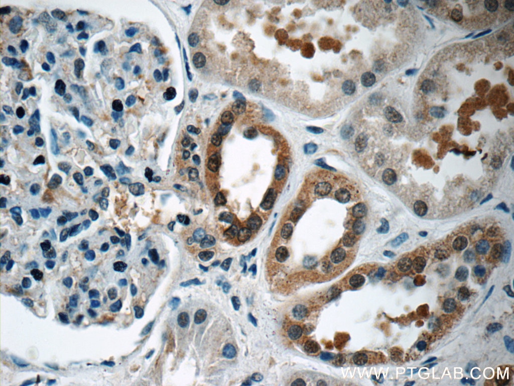 Immunohistochemistry (IHC) staining of human kidney tissue using FKBP52 Polyclonal antibody (22623-1-AP)