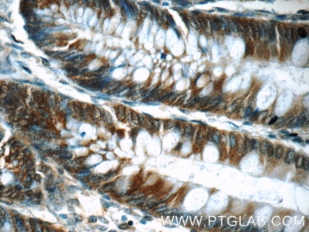 Immunohistochemistry (IHC) staining of human colon tissue using FKBP52 Polyclonal antibody (22623-1-AP)