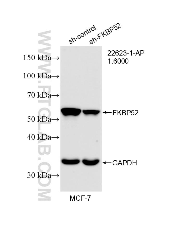 Western Blot (WB) analysis of MCF-7 cells using FKBP52 Polyclonal antibody (22623-1-AP)