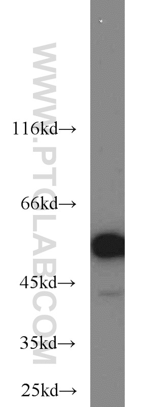 Western Blot (WB) analysis of PC-3 cells using FKBP52 Polyclonal antibody (22623-1-AP)