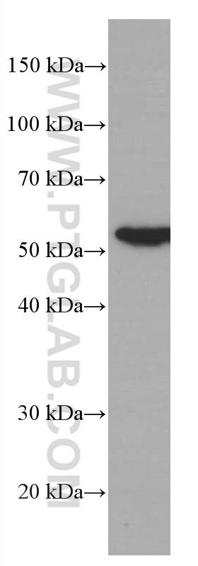 Western Blot (WB) analysis of K-562 cells using FKBP52 Monoclonal antibody (66040-1-Ig)