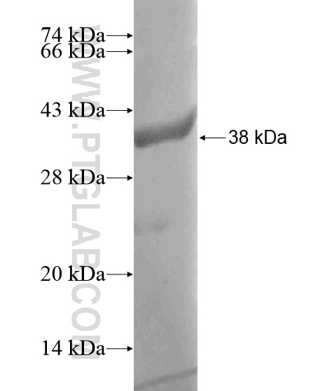 FKBP52 fusion protein Ag18704 SDS-PAGE