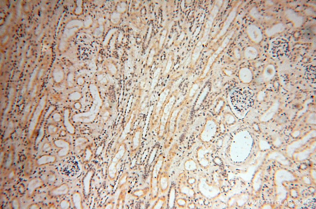 Immunohistochemistry (IHC) staining of human kidney tissue using FKBP6 Polyclonal antibody (13582-1-AP)