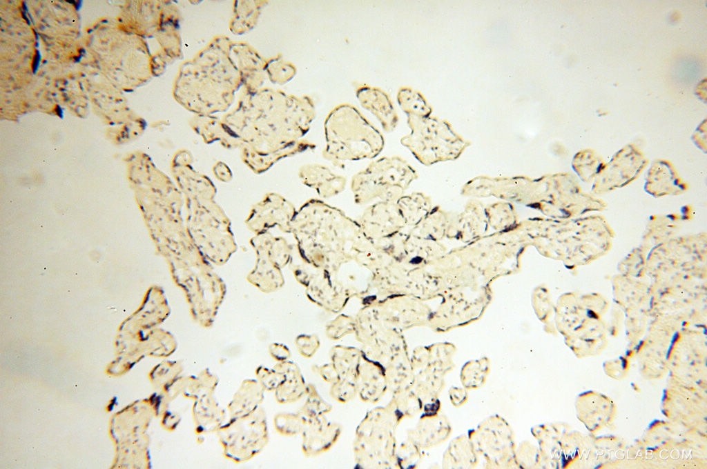 Immunohistochemistry (IHC) staining of human placenta tissue using FKBP6 Polyclonal antibody (13582-1-AP)