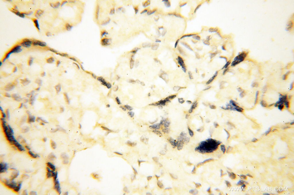 Immunohistochemistry (IHC) staining of human placenta tissue using FKBP6 Polyclonal antibody (13582-1-AP)