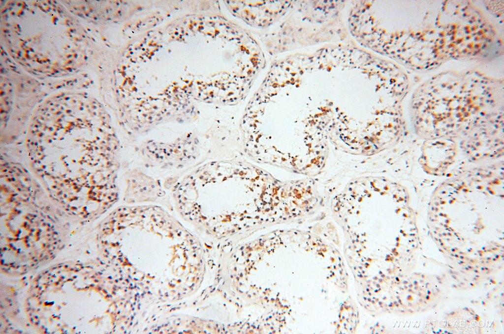Immunohistochemistry (IHC) staining of human testis tissue using FKBP6 Polyclonal antibody (13582-1-AP)