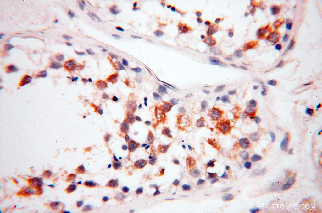 Immunohistochemistry (IHC) staining of human testis tissue using FKBP6 Polyclonal antibody (13582-1-AP)