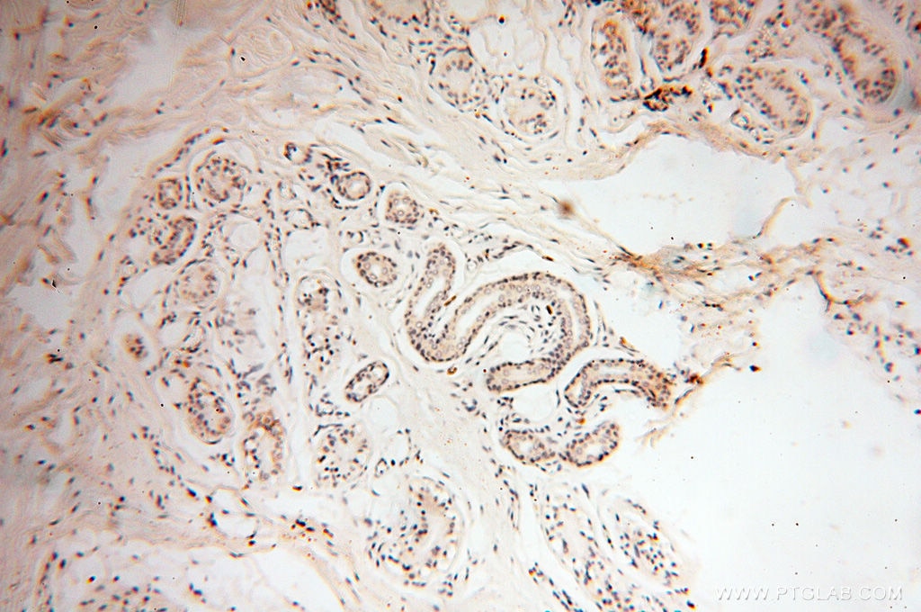 Immunohistochemistry (IHC) staining of human skin tissue using FKBP6 Polyclonal antibody (13582-1-AP)