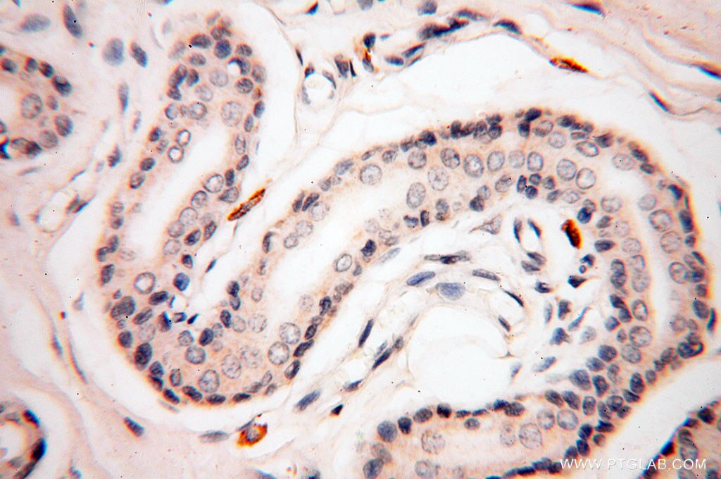 IHC staining of human skin using 13582-1-AP