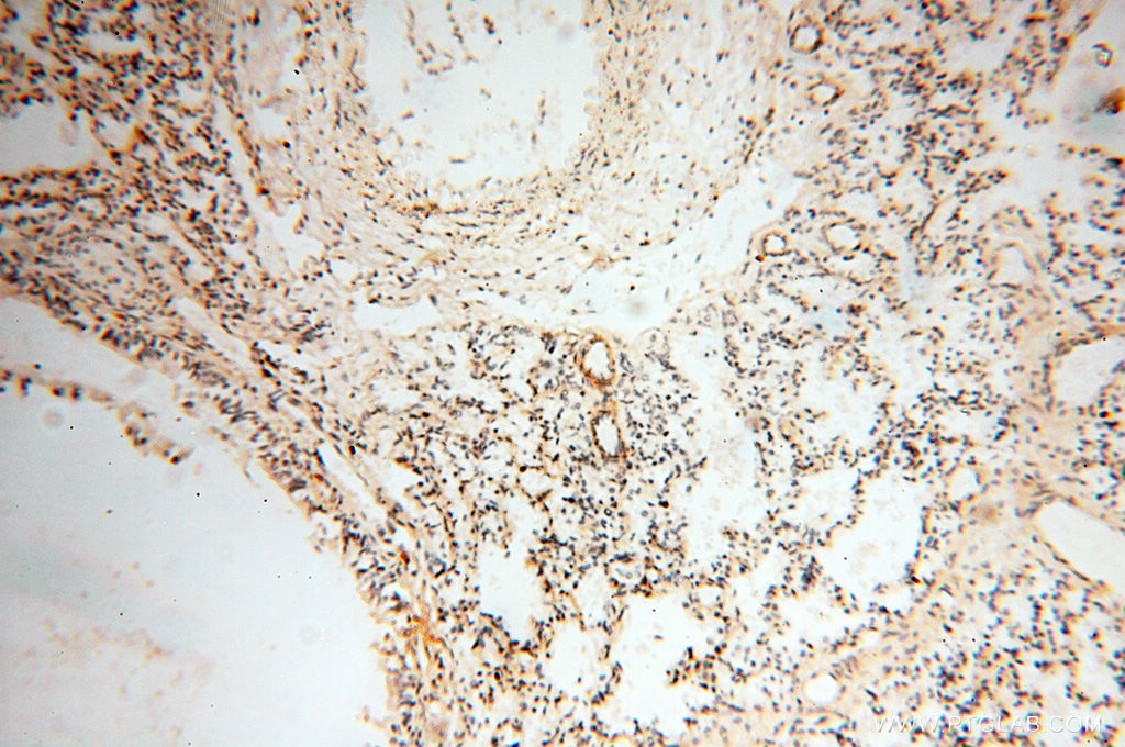 Immunohistochemistry (IHC) staining of human lung tissue using FKBP6 Polyclonal antibody (13582-1-AP)