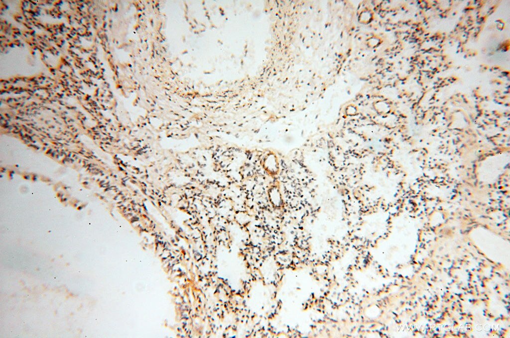 Immunohistochemistry (IHC) staining of human lung tissue using FKBP6 Polyclonal antibody (13582-1-AP)
