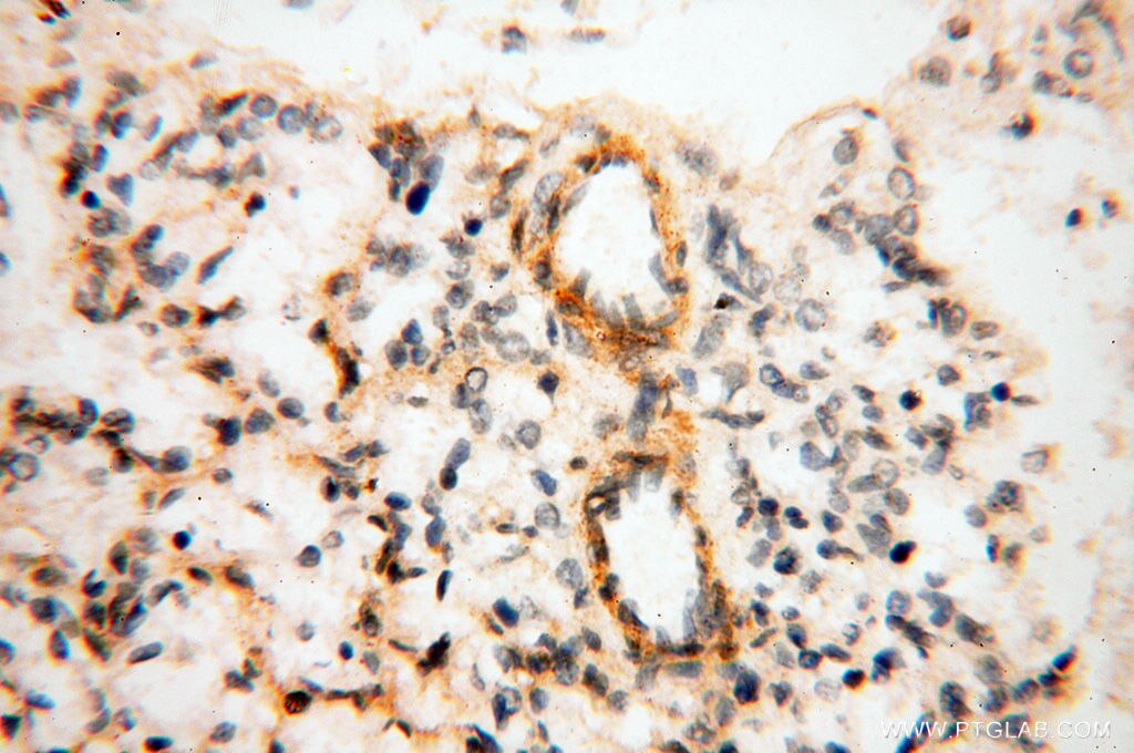 Immunohistochemistry (IHC) staining of human lung tissue using FKBP6 Polyclonal antibody (13582-1-AP)