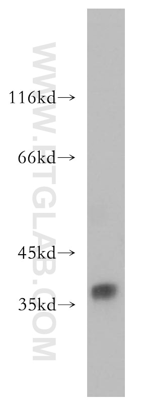 Western Blot (WB) analysis of human testis tissue using FKBP6 Polyclonal antibody (13582-1-AP)