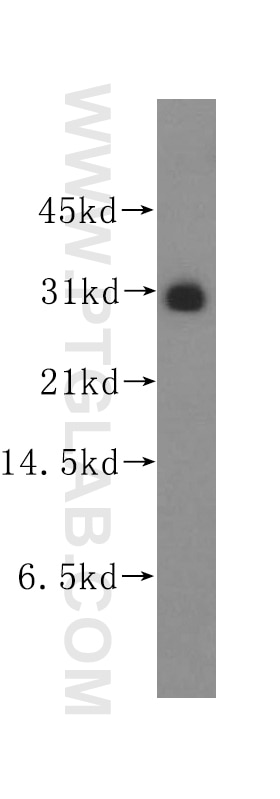 Western Blot (WB) analysis of human lung tissue using FKBP7 Polyclonal antibody (12092-1-AP)