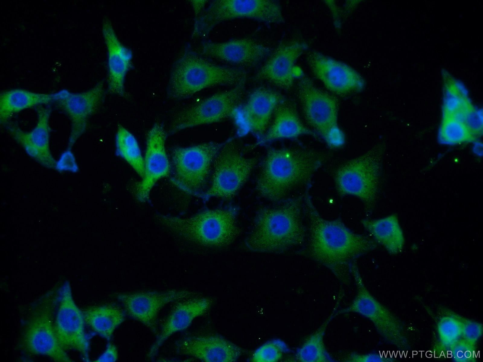 Immunofluorescence (IF) / fluorescent staining of SH-SY5Y cells using FKBP8 Polyclonal antibody (11173-1-AP)