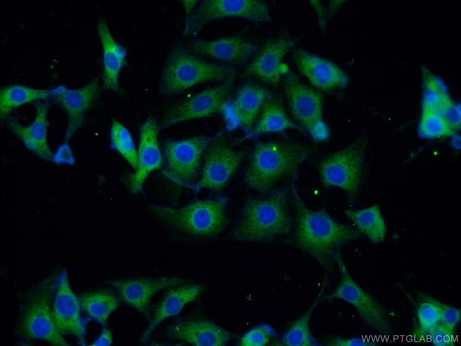 IF Staining of SH-SY5Y using 11173-1-AP