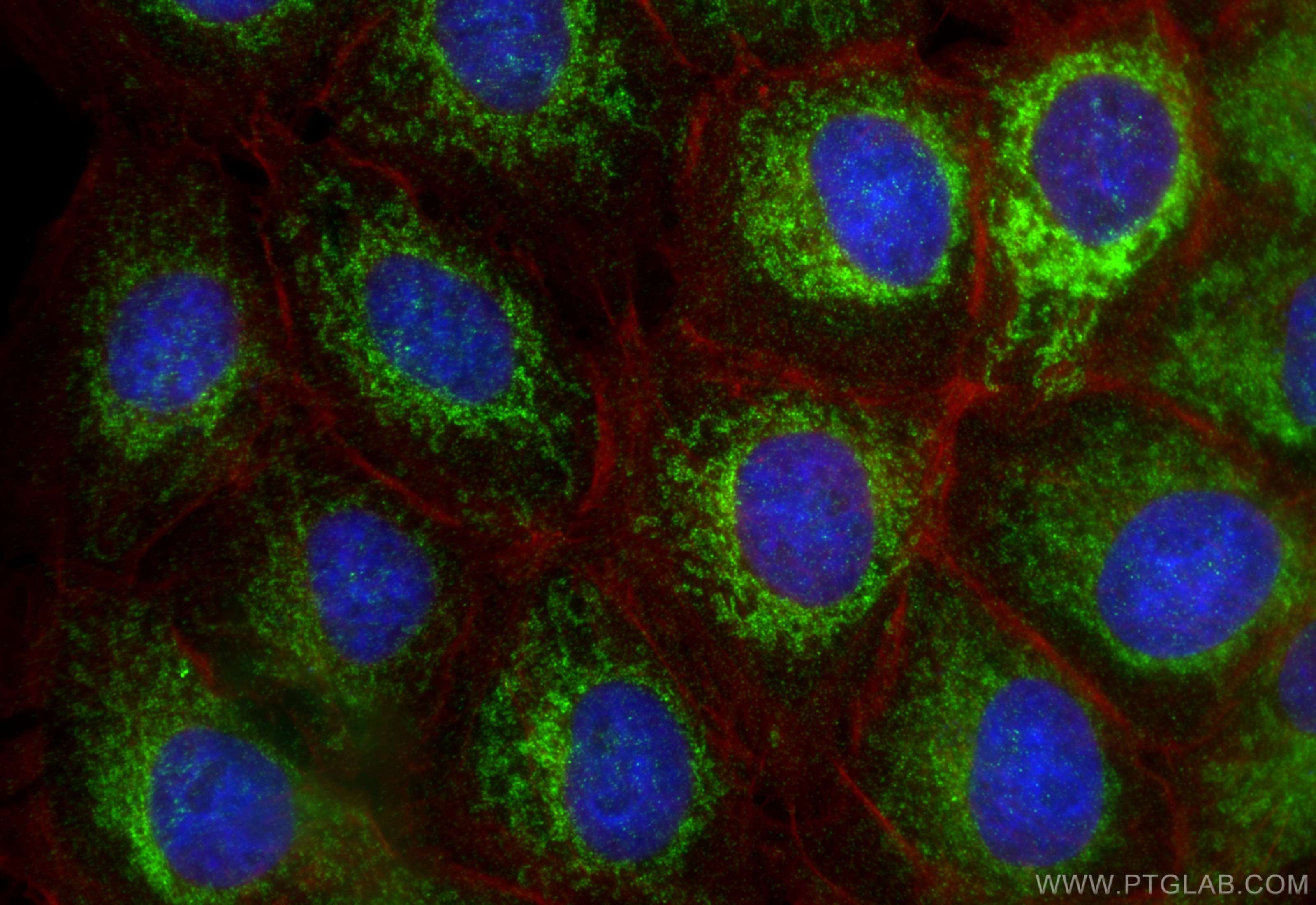 Immunofluorescence (IF) / fluorescent staining of A431 cells using FKBP8 Polyclonal antibody (11173-1-AP)