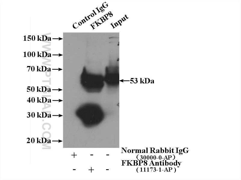 IP experiment of HeLa using 11173-1-AP