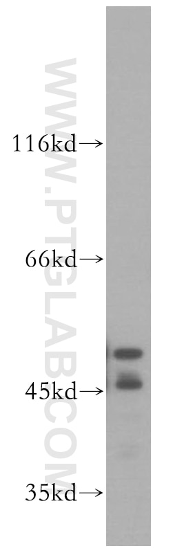Western Blot (WB) analysis of mouse liver tissue using FKBP8 Polyclonal antibody (11173-1-AP)
