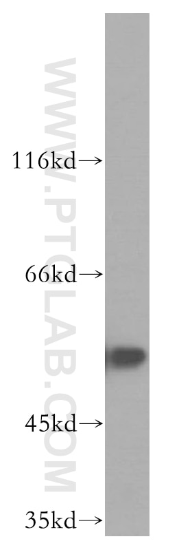 Western Blot (WB) analysis of SH-SY5Y cells using FKBP8 Polyclonal antibody (11173-1-AP)