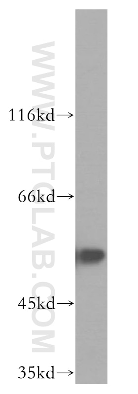 WB analysis of SH-SY5Y using 11173-1-AP