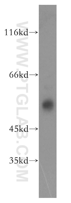 Western Blot (WB) analysis of mouse brain tissue using FKBP8 Polyclonal antibody (11173-1-AP)