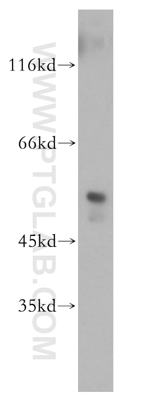 Western Blot (WB) analysis of mouse pancreas tissue using FKBP8 Polyclonal antibody (11173-1-AP)