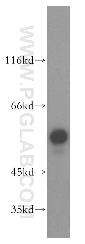 Western Blot (WB) analysis of Jurkat cells using FKBP8 Polyclonal antibody (11173-1-AP)