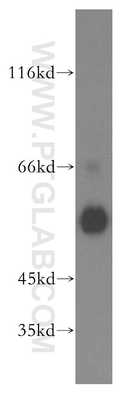 Western Blot (WB) analysis of HeLa cells using FKBP8 Polyclonal antibody (11173-1-AP)