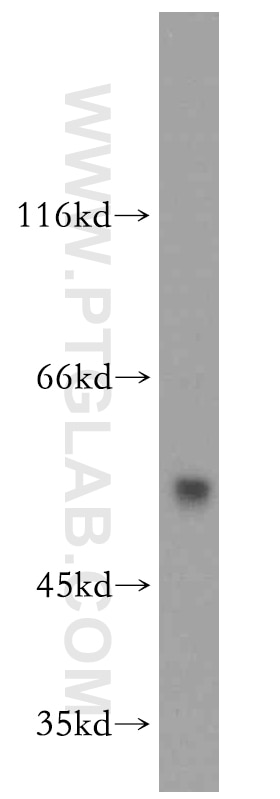 Western Blot (WB) analysis of mouse brain tissue using FKBP8 Polyclonal antibody (11173-1-AP)