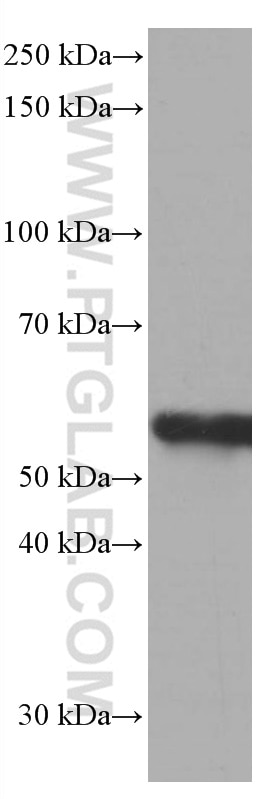 Western Blot (WB) analysis of HeLa cells using FKBP8 Monoclonal antibody (66690-1-Ig)