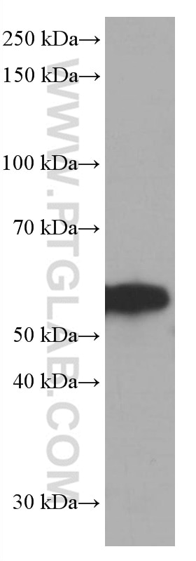 Western Blot (WB) analysis of Jurkat cells using FKBP8 Monoclonal antibody (66690-1-Ig)