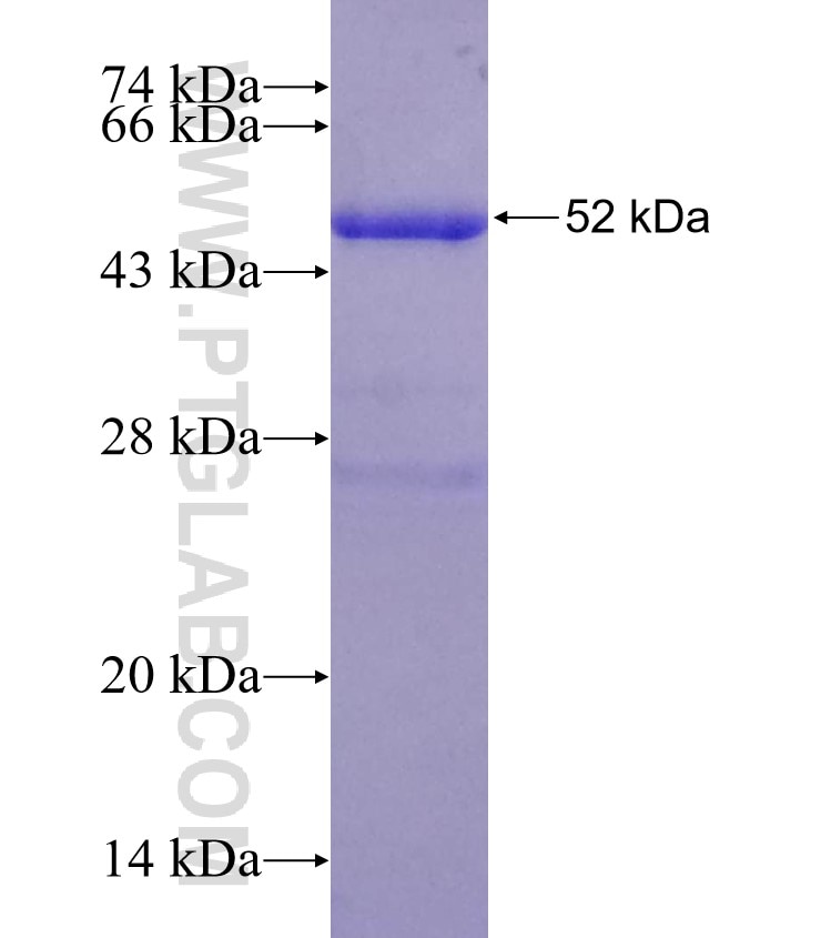 FKBP8 fusion protein Ag1649 SDS-PAGE