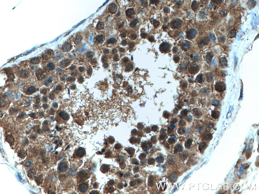 Immunohistochemistry (IHC) staining of human testis tissue using FKBPL Polyclonal antibody (10060-1-AP)