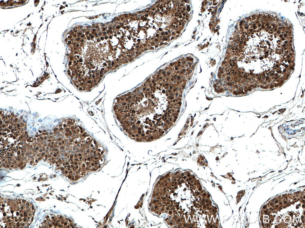 Immunohistochemistry (IHC) staining of human testis tissue using FKBPL Polyclonal antibody (10060-1-AP)