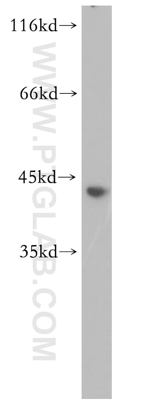 Western Blot (WB) analysis of Jurkat cells using FKBPL Polyclonal antibody (10060-1-AP)