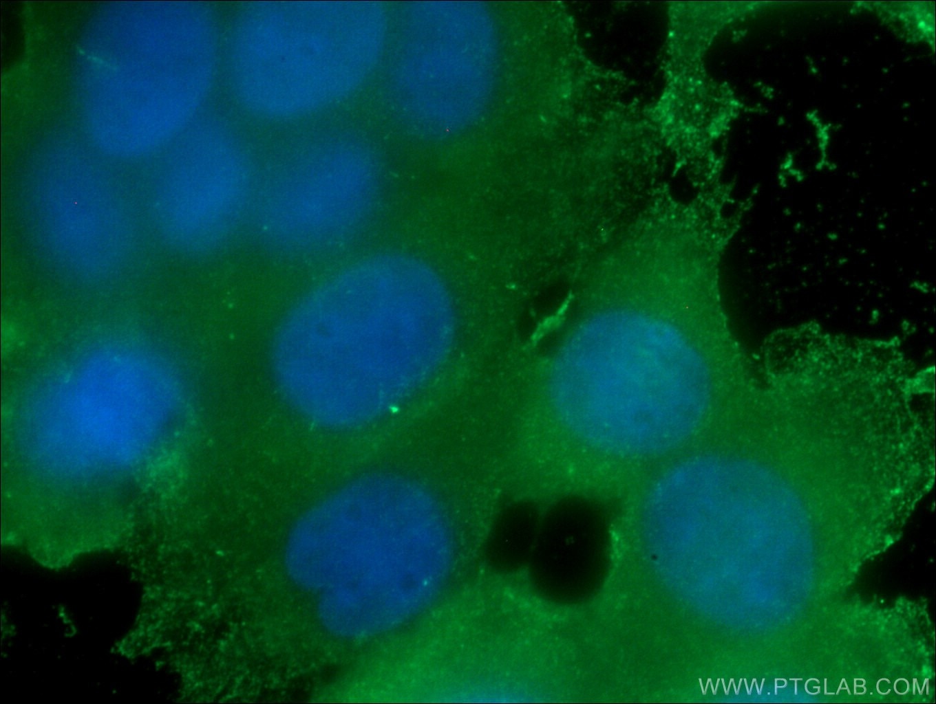 IF Staining of MCF-7 using 66389-1-Ig