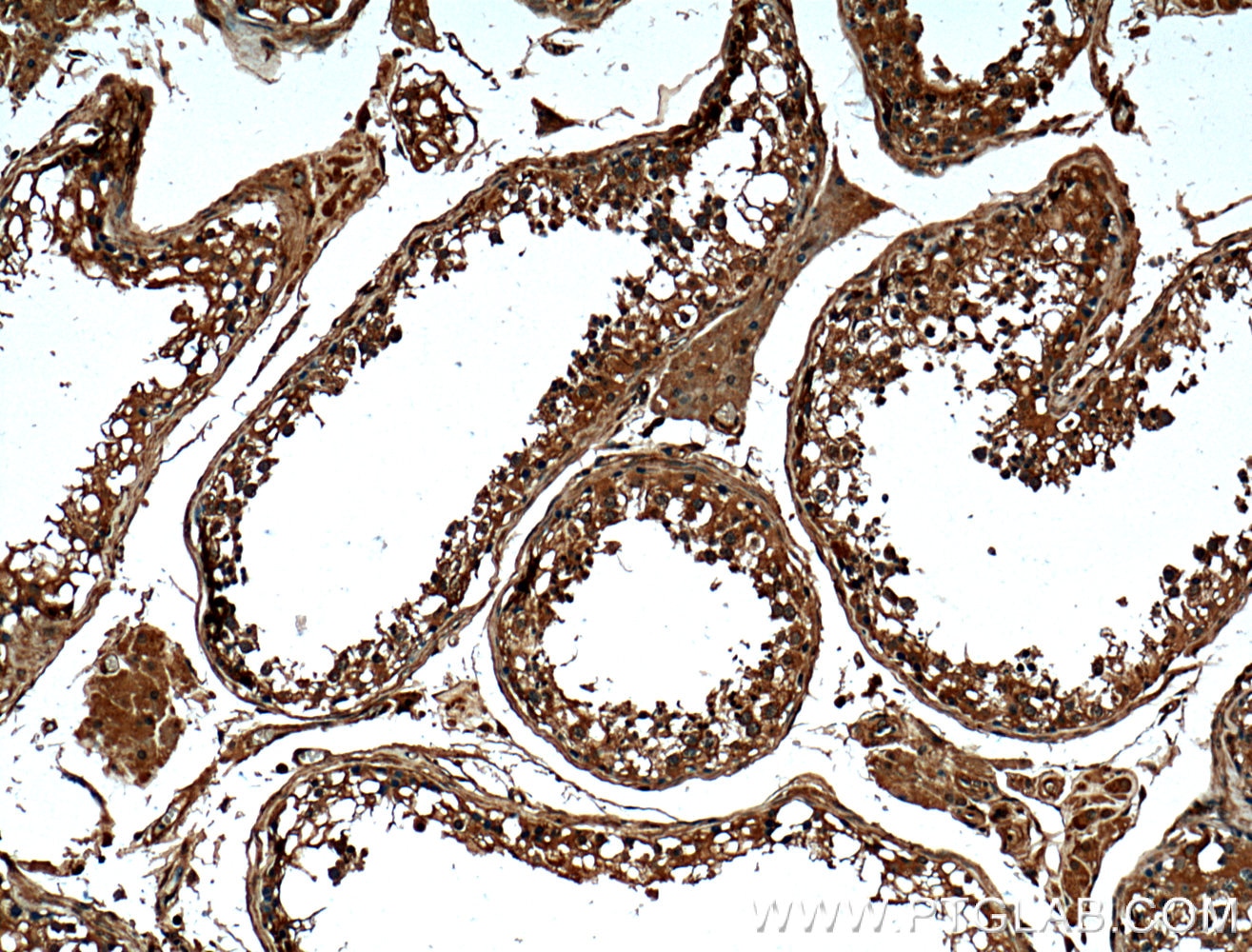 IHC staining of human testis using 66389-1-Ig