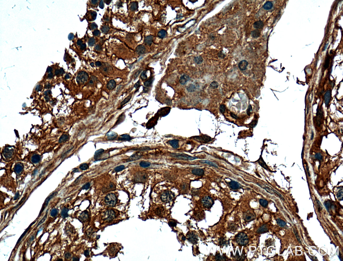 Immunohistochemistry (IHC) staining of human testis tissue using FKBPL Monoclonal antibody (66389-1-Ig)