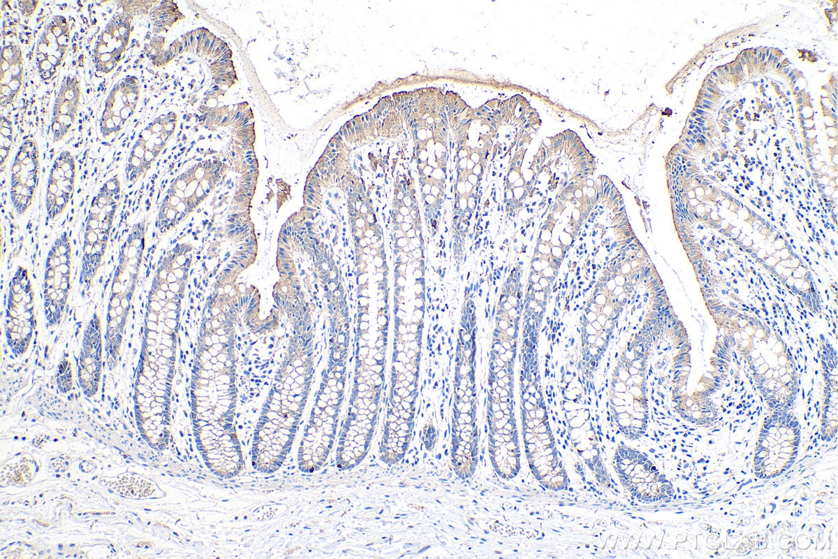 Immunohistochemistry (IHC) staining of human colon tissue using Fukutin Polyclonal antibody (18276-1-AP)