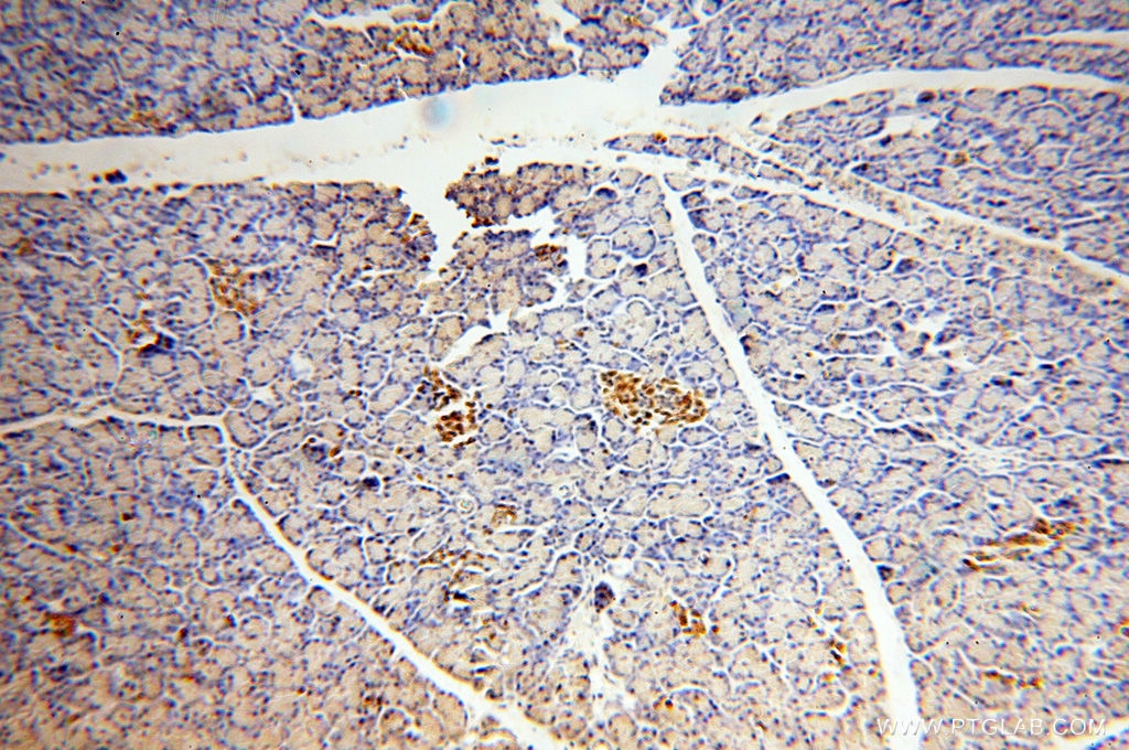 Immunohistochemistry (IHC) staining of human pancreas tissue using Fukutin Polyclonal antibody (18276-1-AP)