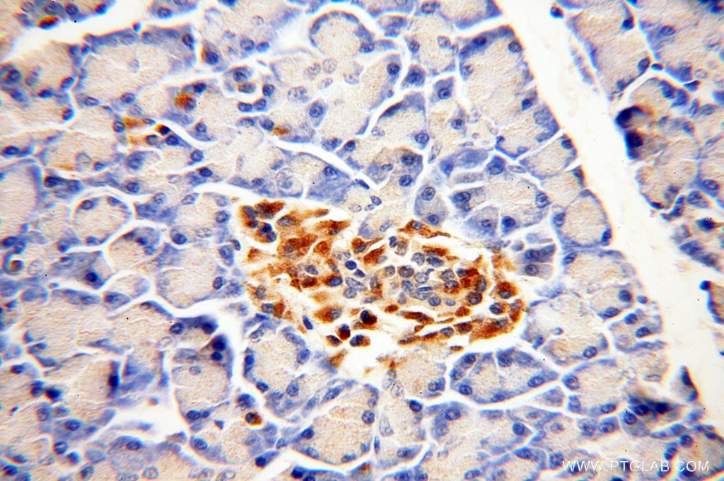 Immunohistochemistry (IHC) staining of human pancreas tissue using Fukutin Polyclonal antibody (18276-1-AP)