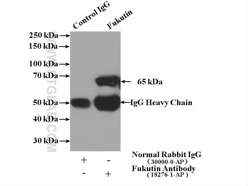 Immunoprecipitation (IP) experiment of mouse brain tissue using Fukutin Polyclonal antibody (18276-1-AP)