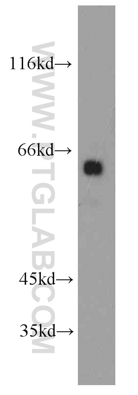 Western Blot (WB) analysis of human brain tissue using Fukutin Polyclonal antibody (18276-1-AP)