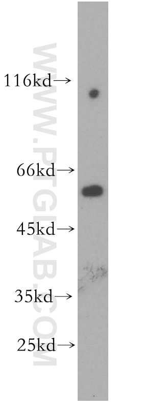 Western Blot (WB) analysis of human brain tissue using Fukutin Polyclonal antibody (18276-1-AP)